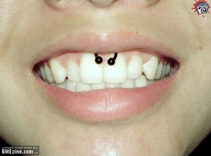 Smiley Piercing