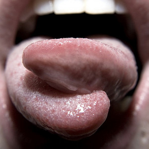 split tongue