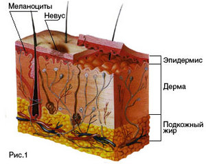 Удалить родинки