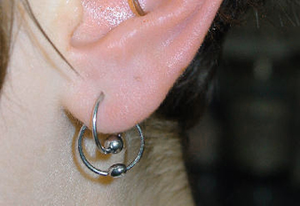 Transverse Lobe