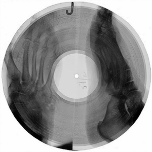 X-ray vinyl | Пластинка из рентгена