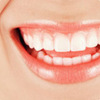 hollywood smile