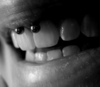 smiley piercing