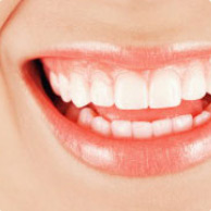 hollywood smile