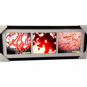 Dexter Framed Blood Splatters